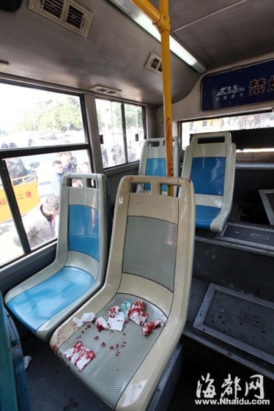 坐在后排的一名乘客頭部撞在桿子上，流了很多血